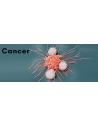 Ingrijire Oncologica