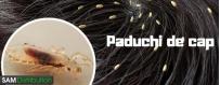 Sampoane si Produse anti Paduchi - Sam-Distribution.ro